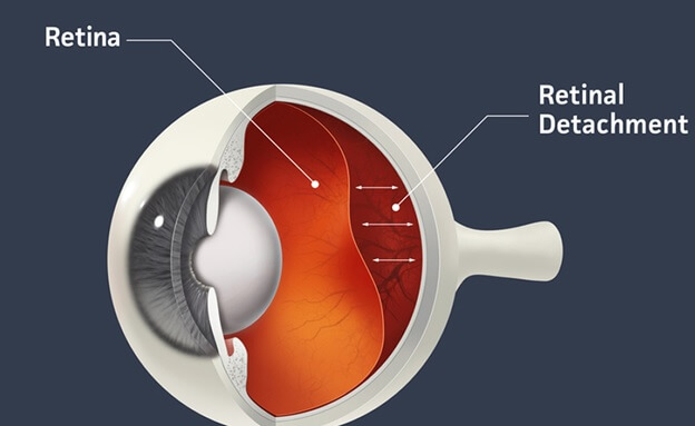 تشخیص با معاینات ساختمانی و وظیفوی چشم